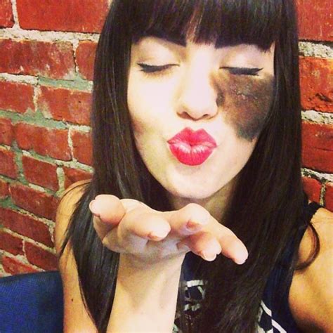 hairy cassandra|Cassandra Naud was born with a hairy birthmark under her left eye.